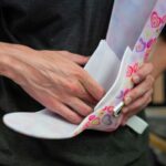 Artrodeza stawu skokowego – skuteczne leczenie Artrodeza stawu skokowego