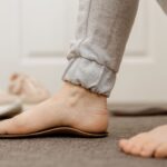 Czy da się wyleczyć płaskostopie u dorosłych? - Do kiedy można leczyć? Czy da się wyleczyć płaskostopie u dorosłych
