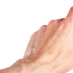 Palec młotkowaty – ćwiczenia Palec młotkowaty – ćwiczenia