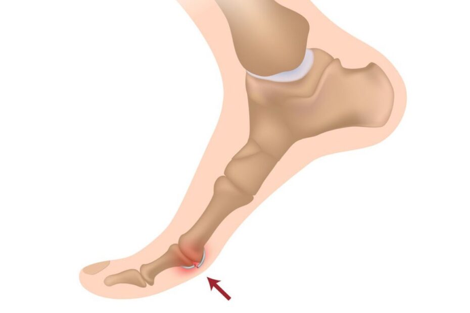 Trzeszczka dwudzielna