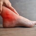 Ból stopy ICD 10 – jak klasyfikować i diagnozować dolegliwości bólowe? ból stopy icd 10