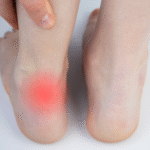 Ból ścięgna w stopie – jakie mogą być przyczyny i jak je leczyć? Ból ścięgna w stopie