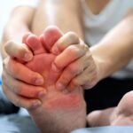 Ból pod stopą przy palcach – o czym świadczy ten objaw? Ból pod stopą przy palcach