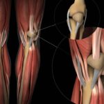 Więzadła w kolanie – rola i najczęstsze problemy Więzadła w kolanie