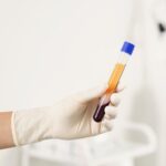 Leczenie osoczem kolana opinie pacjentów i skuteczność Leczenie osoczem kolana opinie pacjentów i skuteczność
