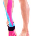 Zerwanie ścięgna Achillesa