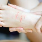 Ból grzbietu stopy – przyczyny i sposoby leczenia bólu ból grzbietu stopy
