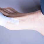 Ból palca przy paznokciu na stopie – co oznacza i jak leczyć? Ból palca przy paznokciu na stopie