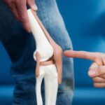 Budowa kolana – najważniejsze elementy i ich funkcje Budowa kolana