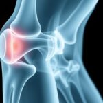 RTG kolana – kiedy wykonać i co pokazuje badanie rtg kolana