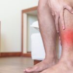 Częste skurcze łydek – objaw niedoborów czy choroby? Częste skurcze łydek