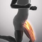 Zerwany mięsień dwugłowy uda – objawy, diagnostyka i leczenie Zerwany mięsień dwugłowy uda