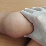 Budowa łydki – mięśnie, ścięgna i funkcje Budowa łydki