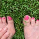 Haluksy małego palca