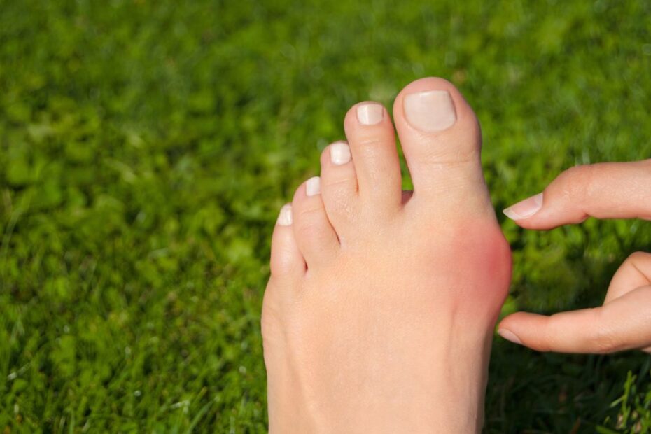 Jak wyglądają haluksy