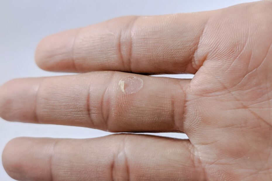 Odciski na dłoniach