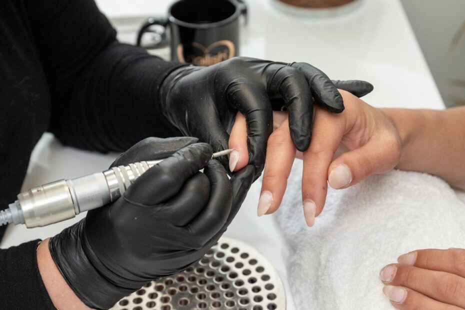 Wrastający paznokieć u ręki