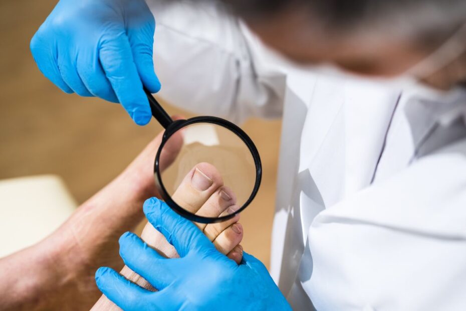 Scholl na wrastające paznokcie