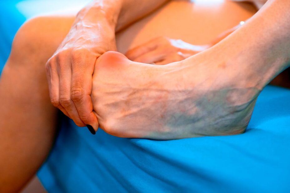 Ortopedyczny aparat na haluksy