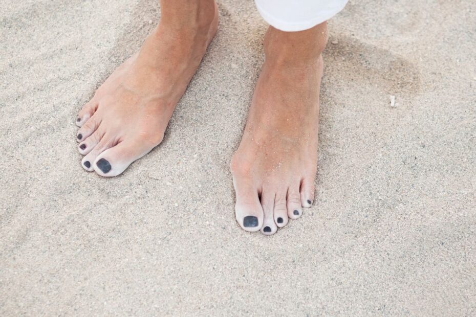 Jak wyprostować haluksy