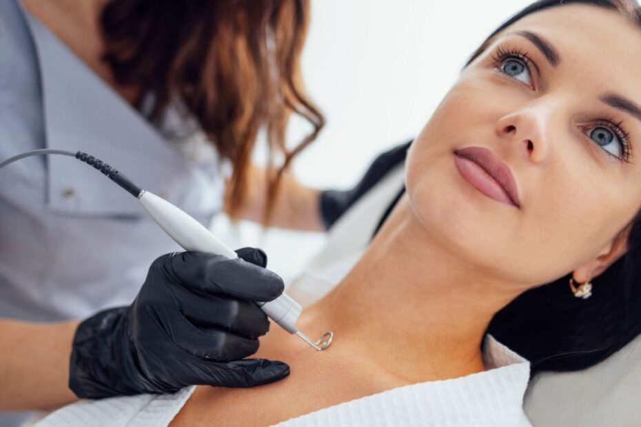 Ból po wymrażaniu kurzajki