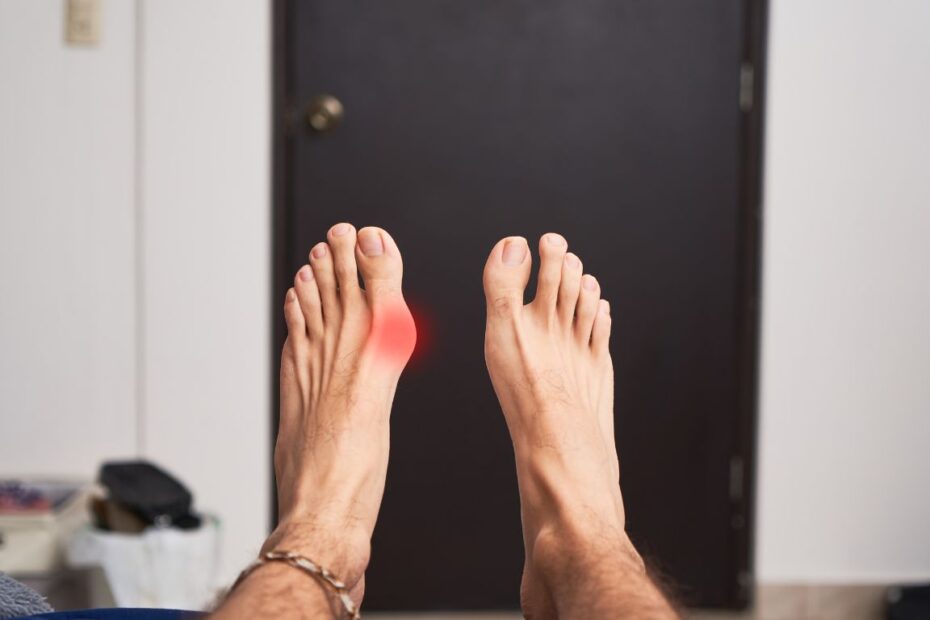 Separator na haluksy