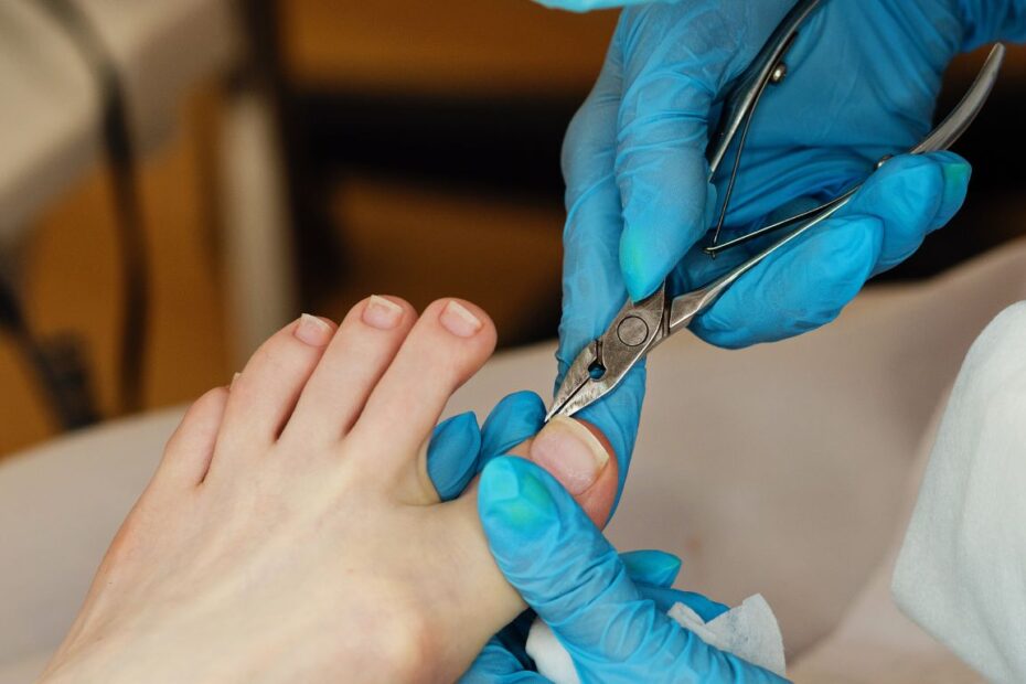 Rurki na wrastające paznokcie