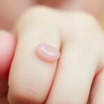 Kurzajka na palcu u dziecka – jak leczyć bezpiecznie? Kurzajka na palcu u dziecka