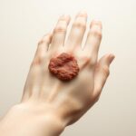 Kurzajka wirusowa – co to jest i jak leczyć? Kurzajka wirusowa