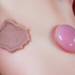 Modzel a odcisk – czym się różnią i jak je leczyć? Modzel a odcisk