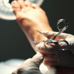 Wycinanie kurzajki – jak przebiega zabieg i czy boli? Wycinanie kurzajki