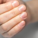 Usunięcie paznokcia gojenie