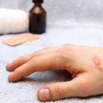 Jak przyśpieszyć gojenie ran