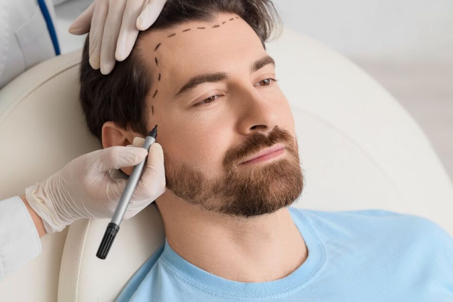 Przeszczep włosów gojenie