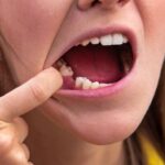 Ile goi się dziąsło po wyrwaniu zęba – jak przebiega proces i jak go wspierać? Ile goi się dziąsło po wyrwaniu zęba