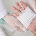 Jak długo goi się rana