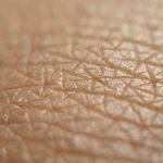 Ile goi się skóra po przeszczepie