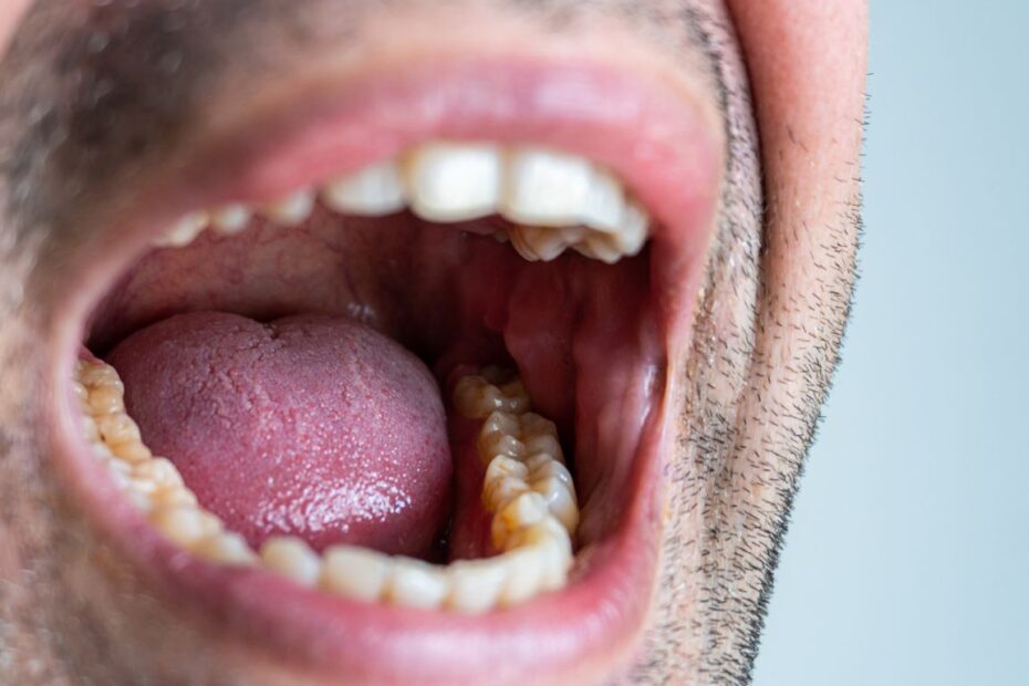 Ile goi się naderwane wędzidełko