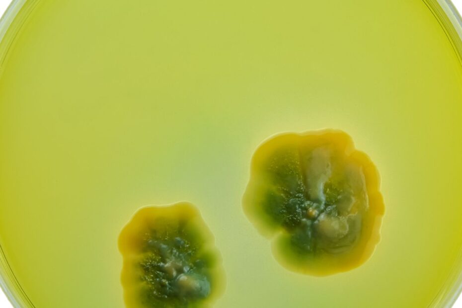 Ile goi się zielona bakteria