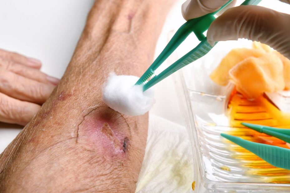 Maść na trudno gojące się rany cukrzycowe bez recepty