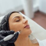 Laserowe usuwanie pieprzyków gojenie