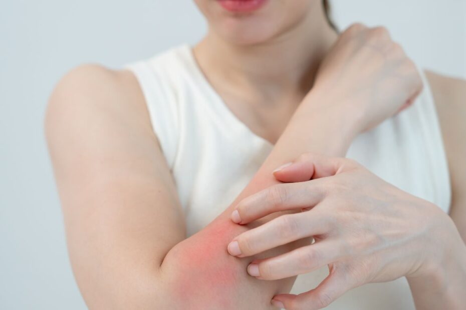 Zdarta skóra ile się goi